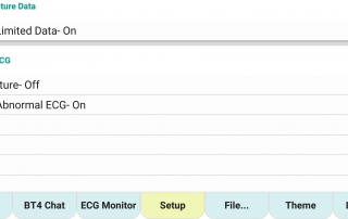 心電圖監視器設定-異常心電圖ecgMonitor-Setting-Abnormal-ecg