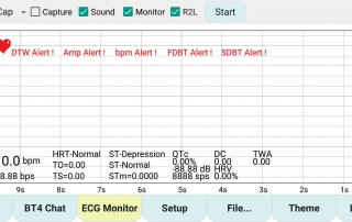 ECG 監視器解讀心律 PQRST Complex-10 年之旅 ECG Monitor Interpretation Heart Rhythm PQRST Complex-10 Year Journey