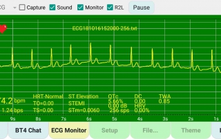 演示人類心電圖-檔案 demo-ecg-human-file