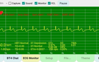 演示人類心電圖 demo-ecg-human