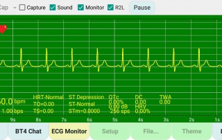 演示-ECG-模擬 demo-ecg-simulation