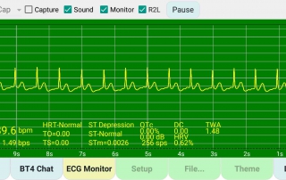 演示即時擷取的心電圖 demo-real-time-ecg-captured