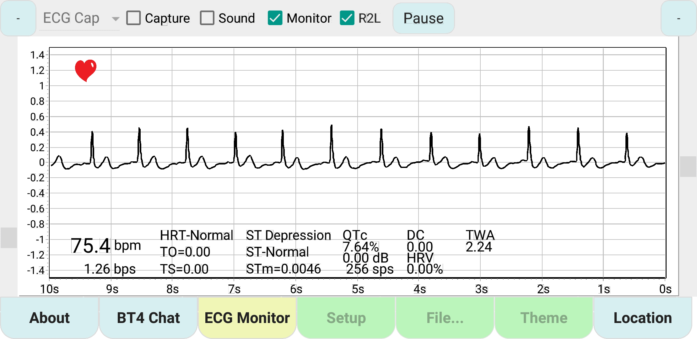 ecg Monitor