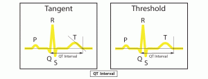 qt interval