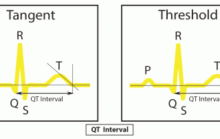 ECG 解讀： QT 分析 ECG Interpretation: QT-Analysis