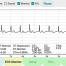 心電圖分析 ecg_analysis_chart