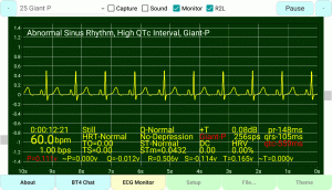 Giant P-Wave