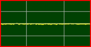 No-ECG/EKG-Signal-or-Asystole