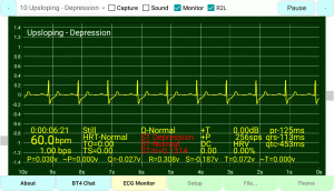 Upsloping-Depression