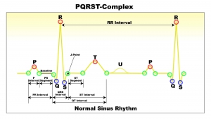 PQRST-Complex-的基本時序圖,捕獲所有轉折點,最大值最小值