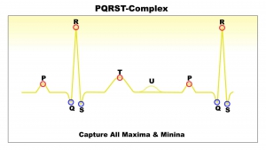 PQRST-Complex-捕獲所有最大值最小值