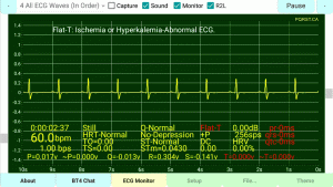 Flat-T-Wave