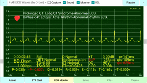 BiPhasic-P-Wave