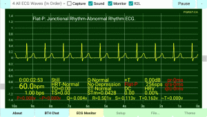 Flat-P-Wave