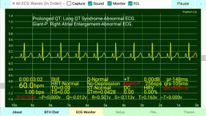 Giant-P-Wave