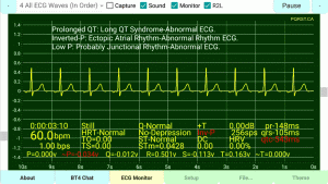 Inverted-P-Wave