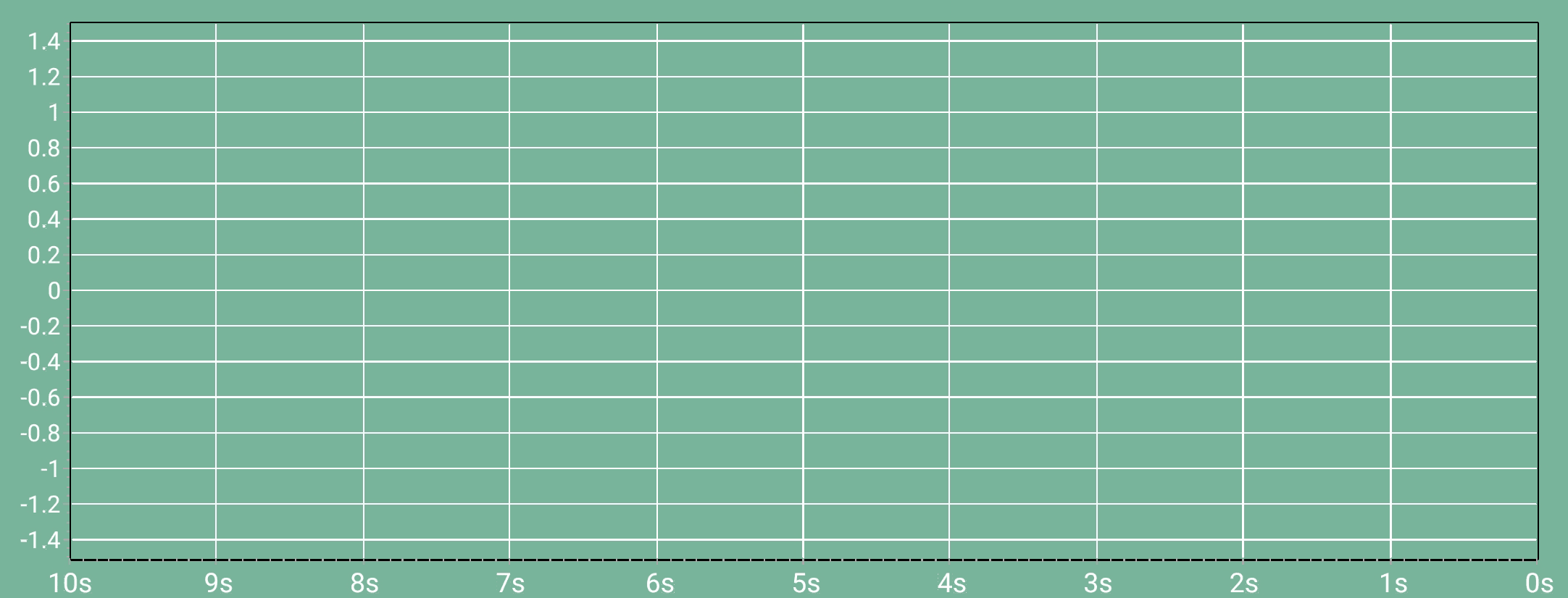 心電圖 ECG Chart